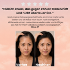 Rotlichtbürste